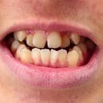 snap-on-smile-5.jpg